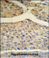 BF Antibody (Center)